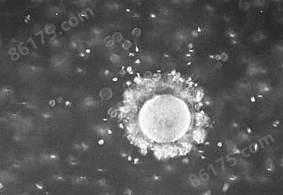 小鼠B淋巴细胞杂交瘤细胞；SH2