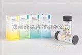 U120-500多项尿检试纸/尿液分析尿检试纸